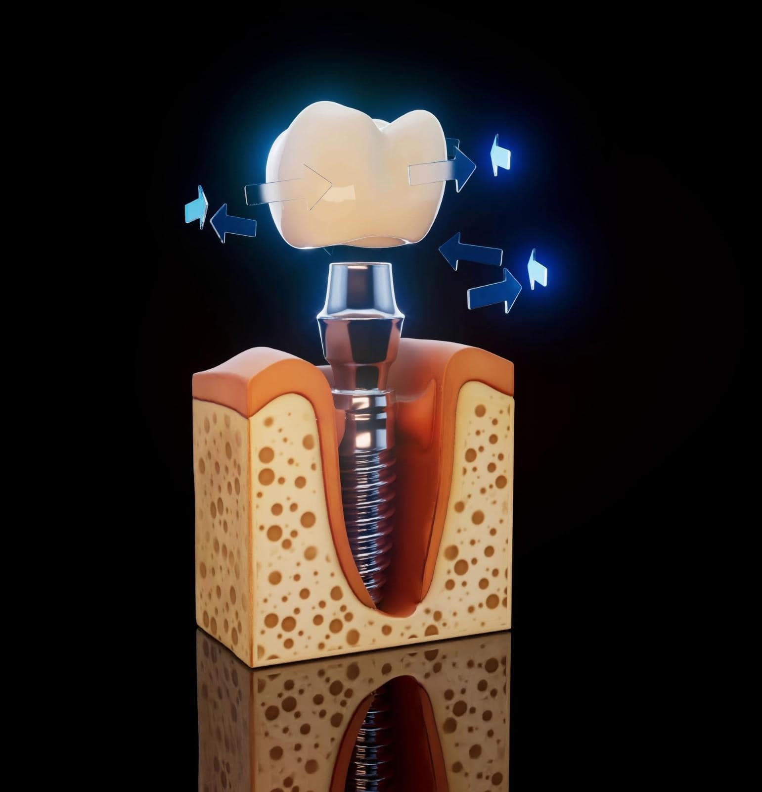 clinica dentale in Albania per impianti in un giorno