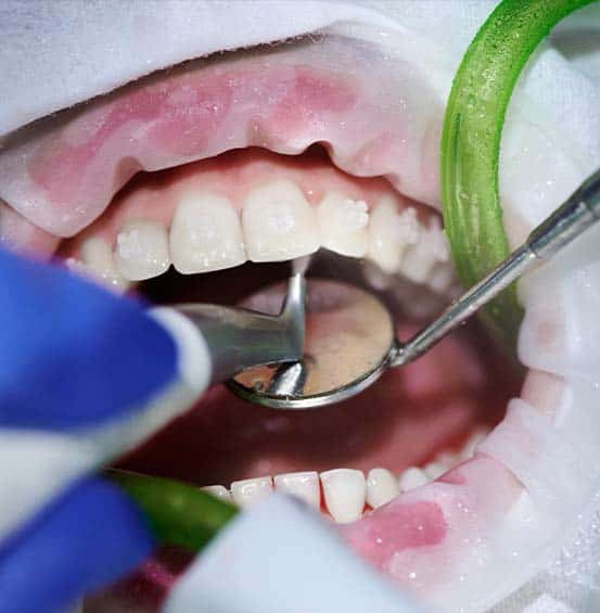 cure dentali a prezzi accessibili in Albania