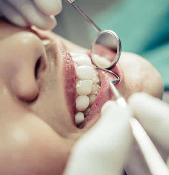 Lidhje kompozite dentare me çmim të përballueshëm në Shqipëri