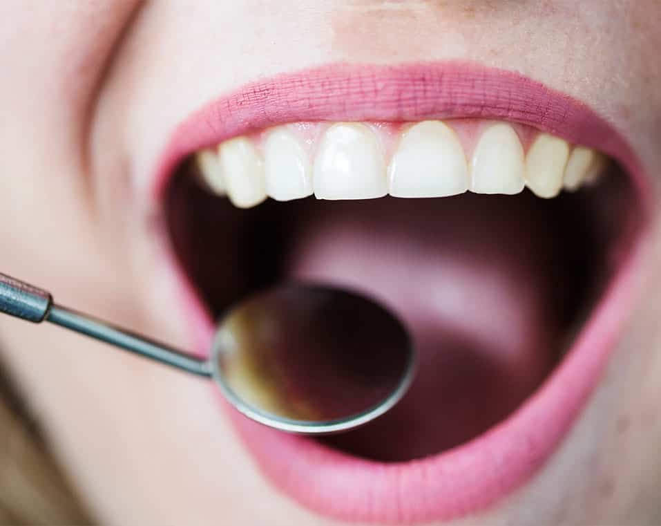 trattamento delle gengive dentali a prezzi accessibili in Albania