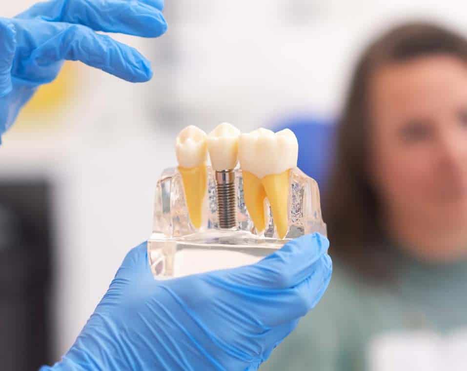 impianti dentali a prezzi accessibili in Albania presso l'American Dental Hospital di Tirana