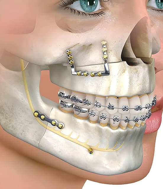 chirurgia mascellare a prezzi accessibili in Albania