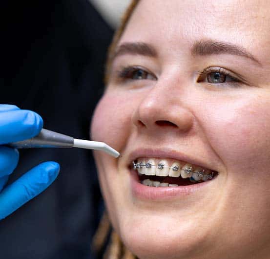 cure ortodontiche a prezzi accessibili in Albania