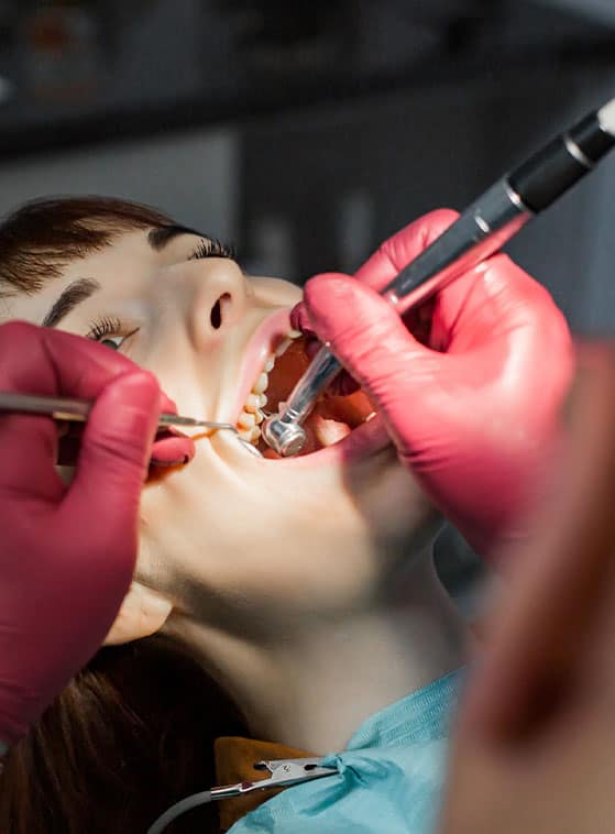 cure dentistiche preventive a prezzi accessibili in Albania