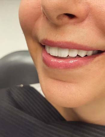 Dentist me rezultate të mahnitshme në Shqipëri