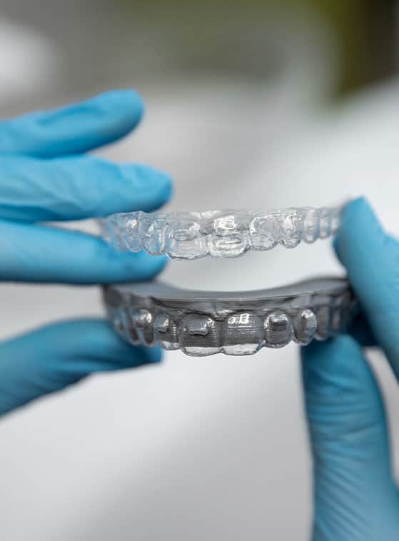Allineatori trasparenti, trattamento Invisalign a prezzi accessibili in Albania