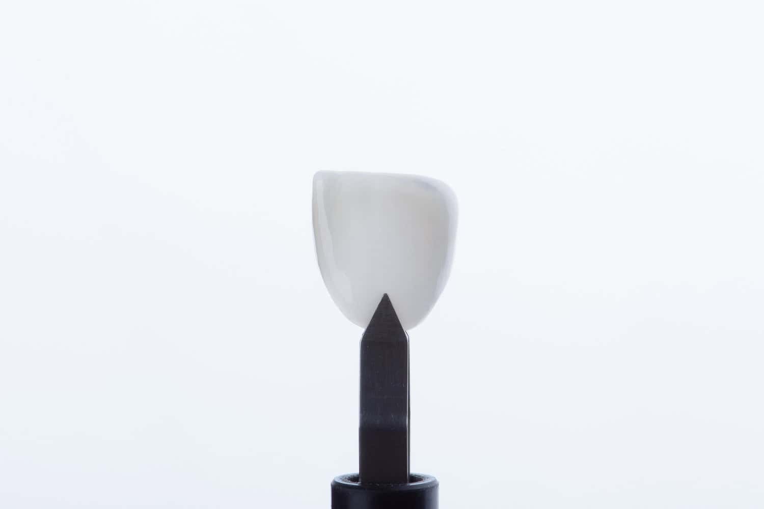 faseta dentare me çmime të përballueshme në Shqipëri