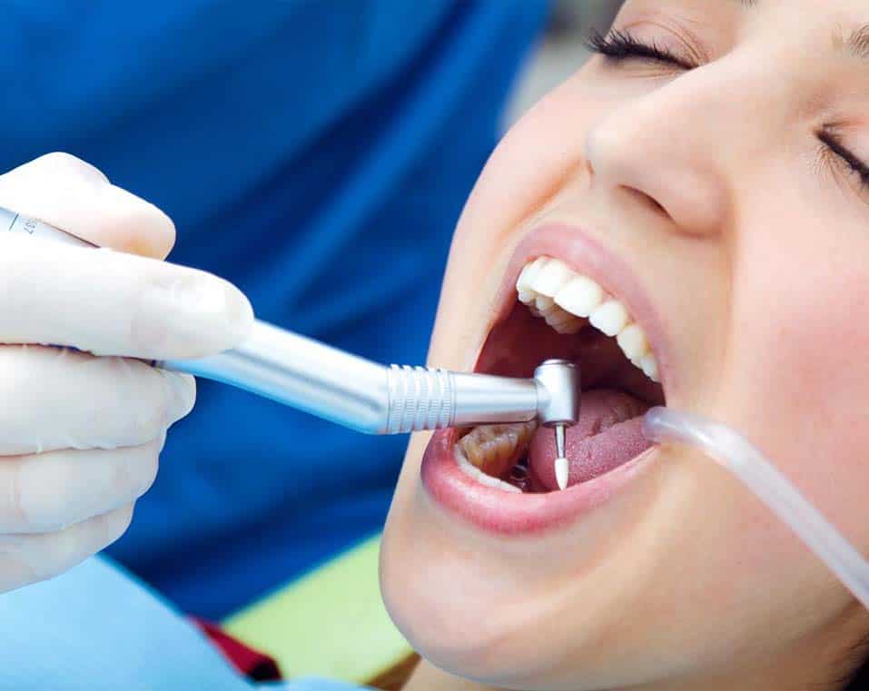 cura dell'igiene dentale in una clinica odontoiatrica in Albania
