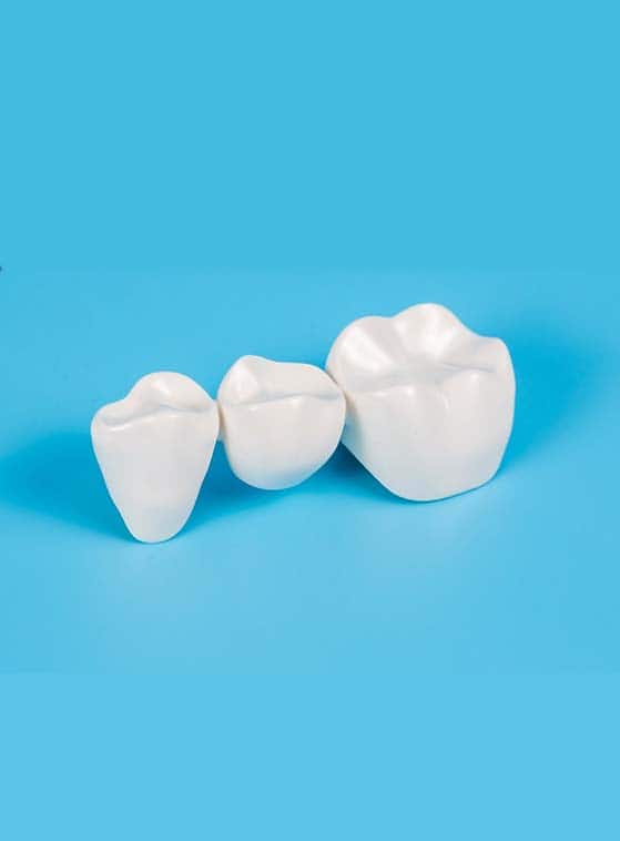 ponti dentali di qualità e di lunga durata in Albania