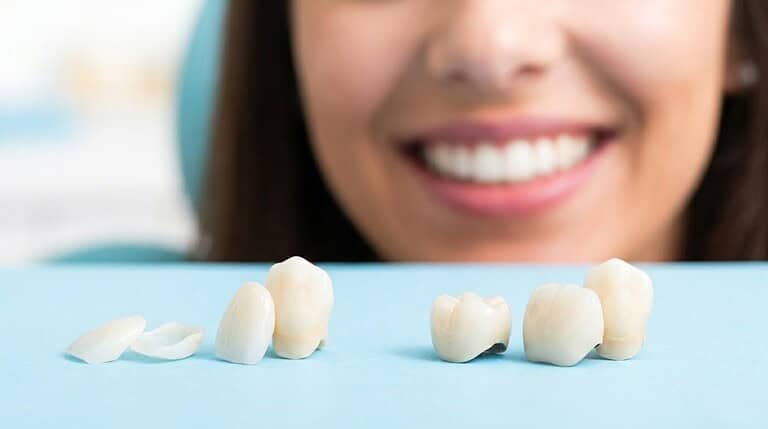 Faccette o Corone per un Sorriso Perfetto? Come Fare la Scelta Giusta