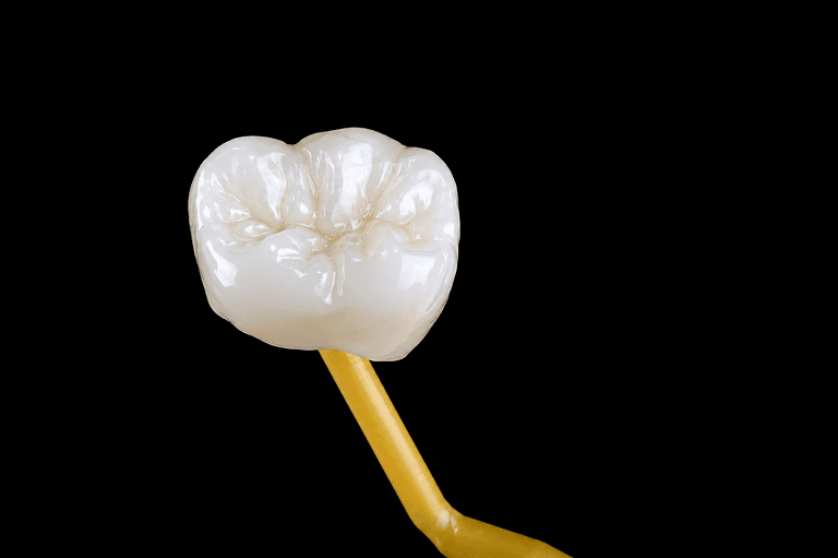 Dental Crowns In Albania: Cost, Materials, And Treatment Timeline