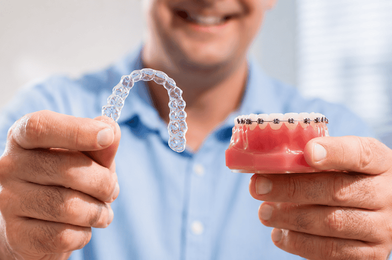 Invisalign Vs Braces: Which Option Fits Your Smile, Age And Lifestyle?