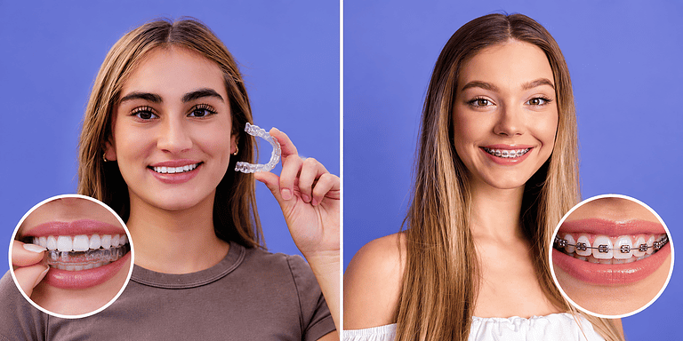 Invisalign vs Braces in Albania: Which Option Is Better?