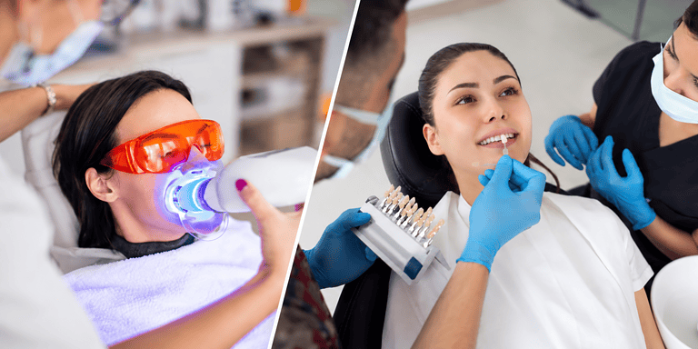 Teeth Whitening vs Veneers: Which Treats Stained Teeth?