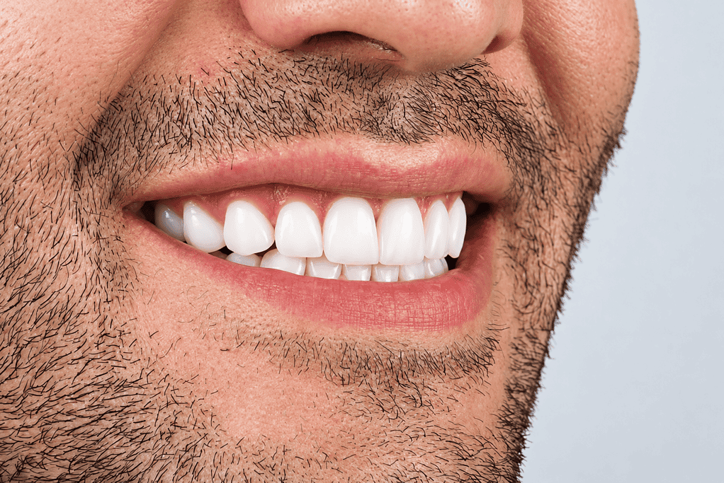 Close-up of a smiling man showing white, healthy teeth and facial hair.