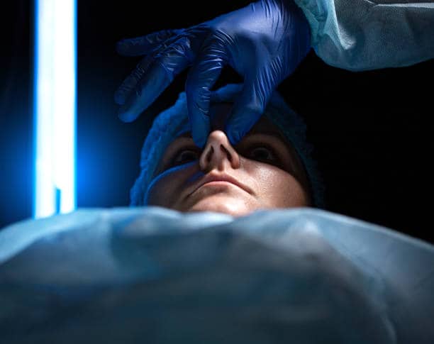 Alar Base Reduction in Albania