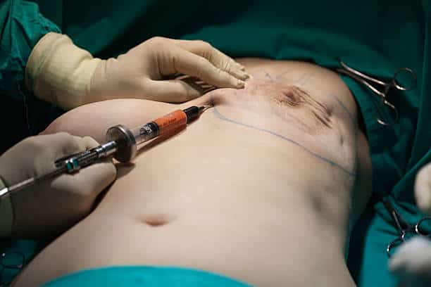 Breast Reconstruction In Albania