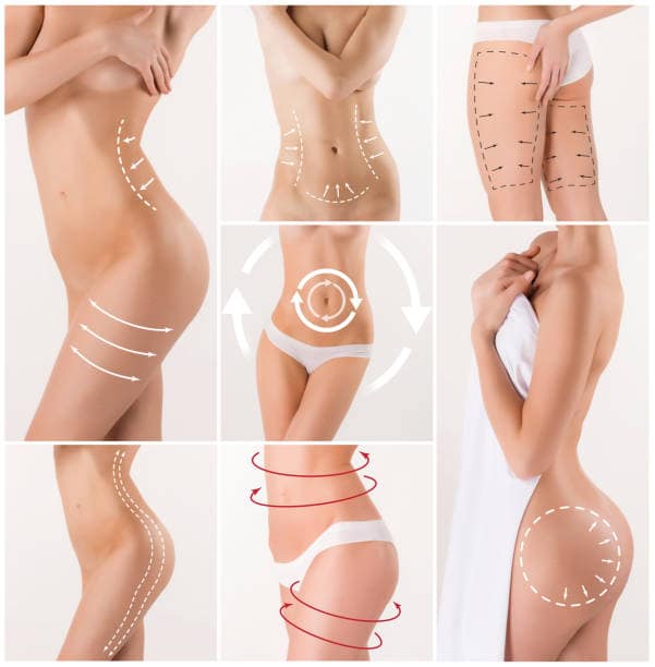 Final Body Lift Results