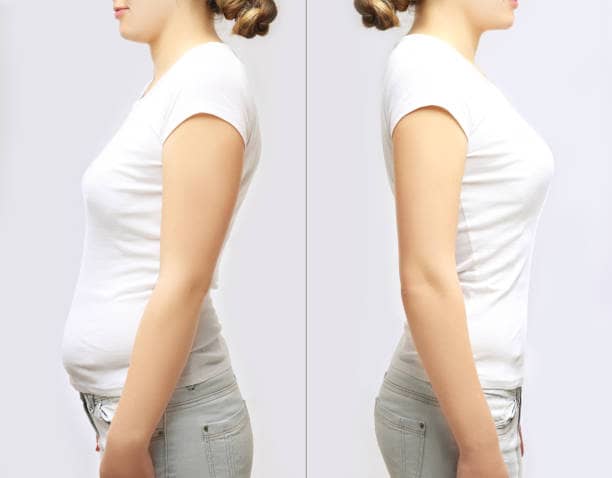 Good Candidate For A Body Lift