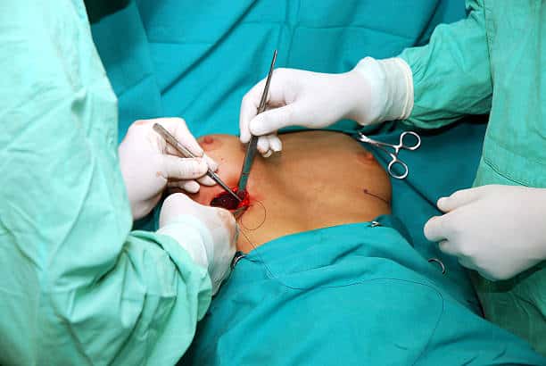 Good Candidate For Breast Implant Replacement