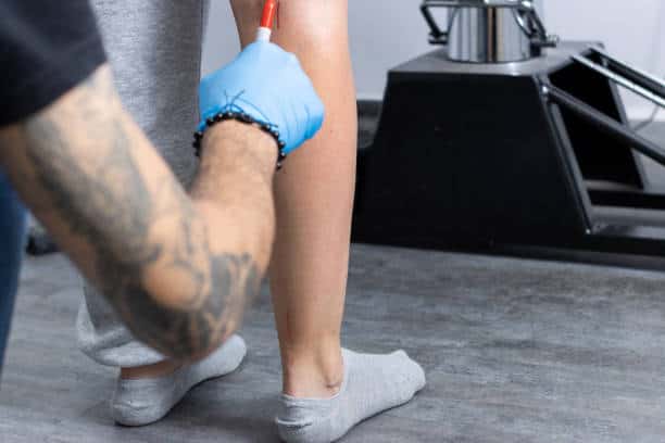 Good Candidate For Calf Augmentation