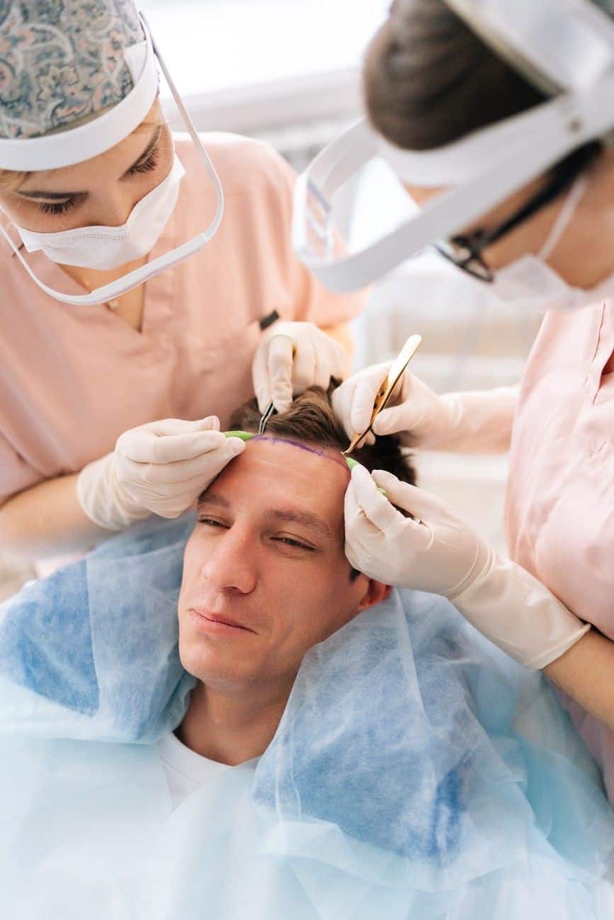 Hair Transplant in Albania