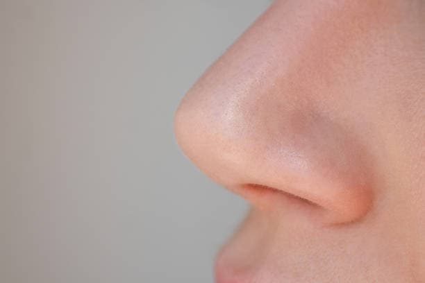 Recovery from Alar Base Reduction