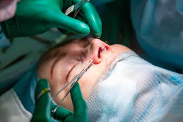 Septoplasty In Albania American Hospital