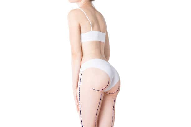 Skinny BBL Candidate