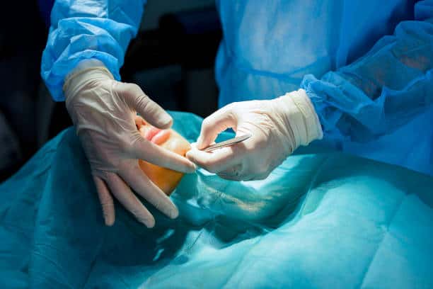 Surgery of chin augmentation