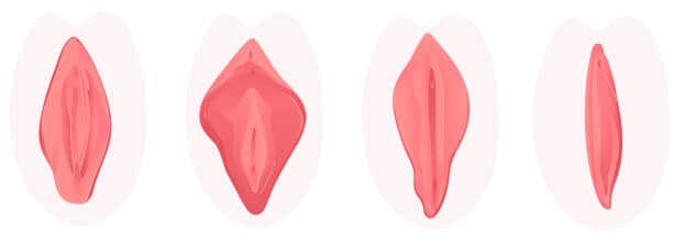 Why Women Choose Labiaplasty