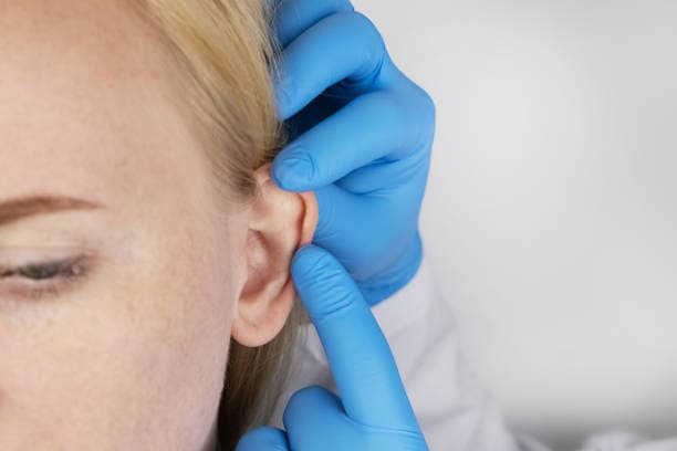 Earlobe Repair in Albania