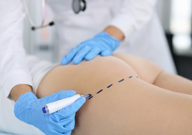 affordable BBL in Albania