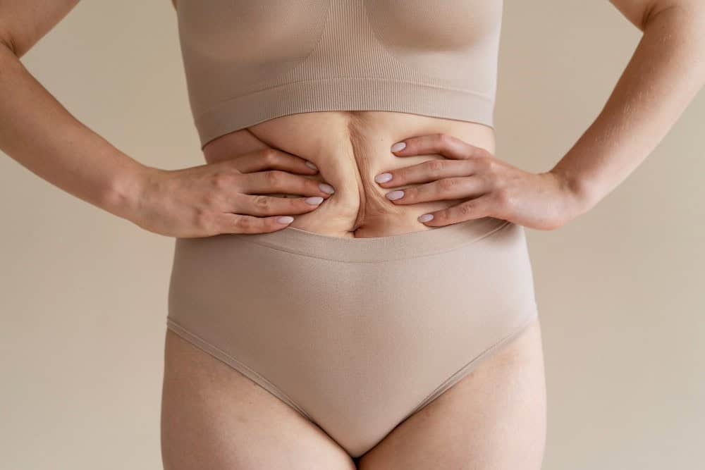 affordable abdominoplasty for stomach fat removal in Albania
