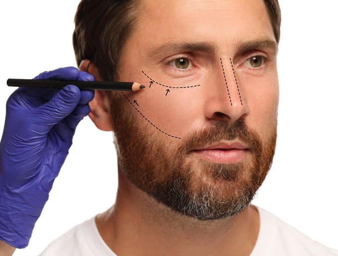 affordable male plastic surgery in Albania