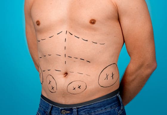 affordable plastic surgery for men in Albania
