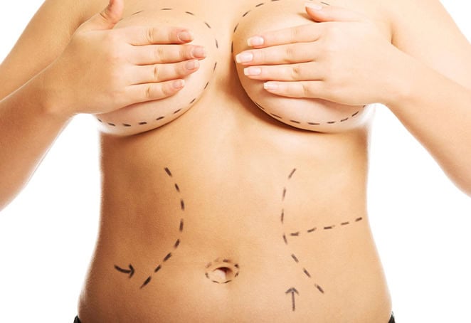 full mommy makeover in Albania