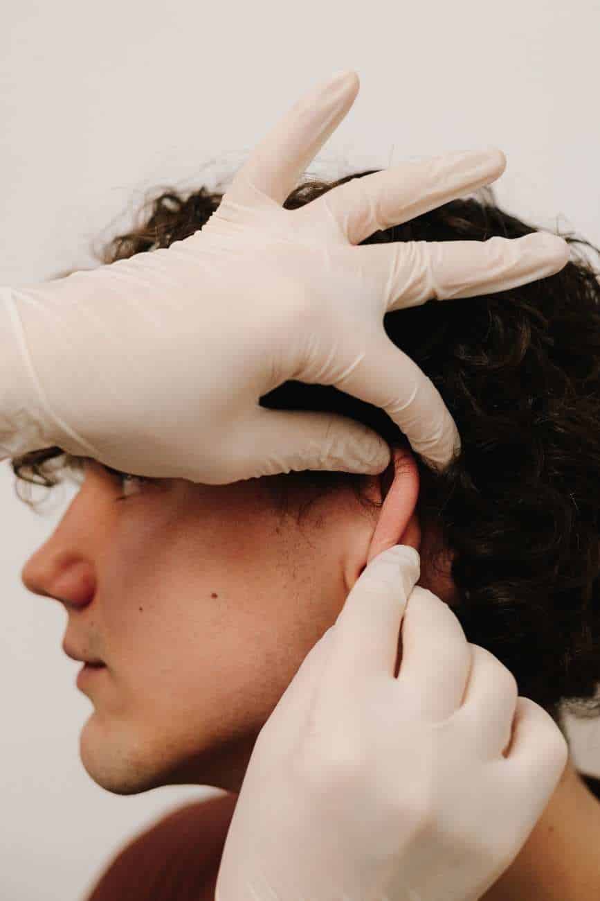 Otoplasty in Albania