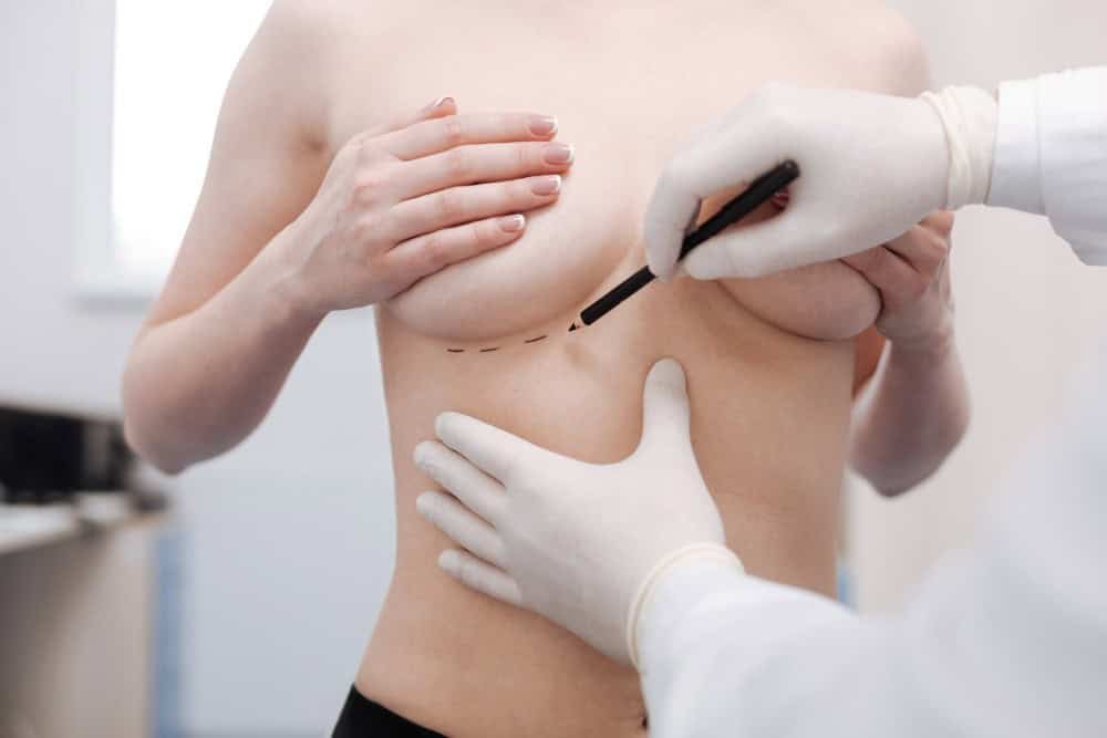 Il dottore esamina il seno della donna per opzioni di lifting o protesi.