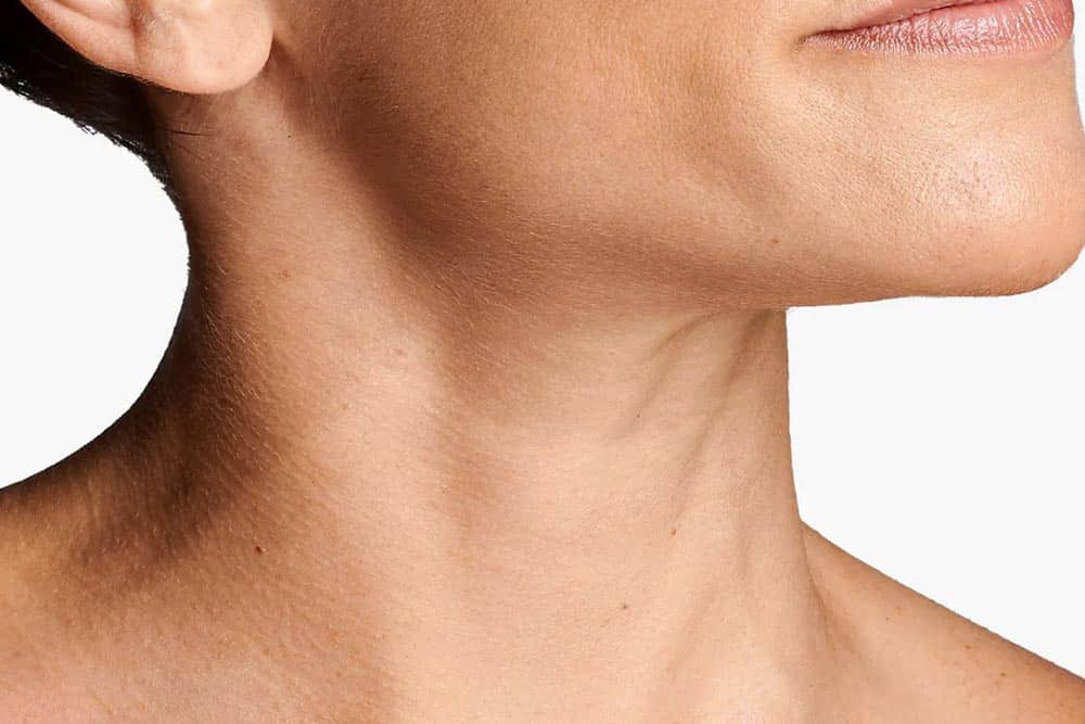 A woman’s neck and jawline after cosmetic surgery, close-up view.