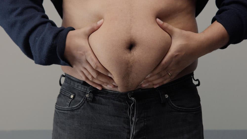 Close-up of a man's abdomen showing excess fat for liposuction treatment.