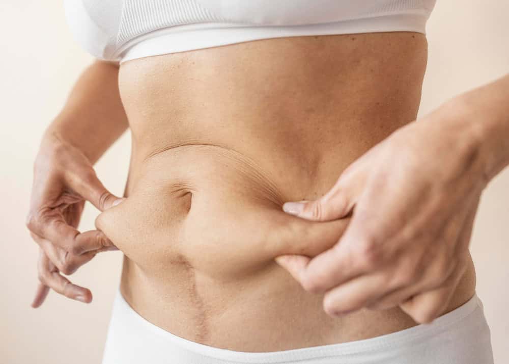 Close-up of a woman pinching excess skin on her abdomen.