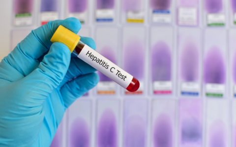 Çfarë duhet të dini për hepatitin dhe llojet e tij