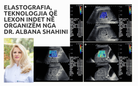 Elastografia, teknologjia që lexon indet në organizëm nga Dr. Albana Shahini