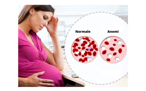 Anemia dhe shtatzënia