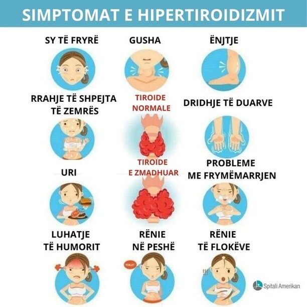 7 ndryshime në stilin e jetës që mund të ndihmojnë tiroiden

1. Rregulloni regjimin e gjumit

Kur tiroidja nuk funksionon siç duhet, ju mund të ndiheni të lodhur, të rraskapitur e madje të keni edhe pagjumësi. Vendosja e një regjimi të rregullt të gjumit është e rëndësishme. Sipas mjekëve, synoni të flini 8 orë dhe përpiquni të shkoni në shtrat në të njëjtën kohë çdo natë.

2. Kryeni aktivitet fizik të moderuar

Ushtrimet e rregullta stimulojnë tiroiden të bëjë punën e saj, por kujdes pasi aktiviteti i tepërt fizik mund ta rëndojë atë. Ushtrimet aerobike me intensitet mesatar, ecja, noti dhe joga janë zgjedhje fantastike për personat me probleme të tiroides. .

3. Praktikoni menaxhimin e stresit

Stresi bën që substancat si kortizoli dhe adrenalina të çlirohen, duke shkaktuar një mori shqetësimesh që mund të ndikojnë drejtpërdrejt në tiroiden tuaj.

4. Ndryshoni dietën tuaj

Dieta të veçanta janë krijuar posaçërisht për njerëzit me sëmundje autoimune si Tiroiditi i Hashimoto, ose "hipotiroidizmi autoimun". Soja, gluteni dhe ushqimet me shumë yndyrë mund të ndërhyjnë në medikamentet e tiroides dhe të ndikojnë negativisht duke penguar trupin të përthitë hormonet e tiroides, ndaj duhet të shmangen.

5. Provoni alternativat bimore

Mjekimet bimore janë duke u përdorur gjithmonë e më shumë, por sigurohuni që të flisni me një mjek më parë, veçanërisht nëse jeni duke marrë mjekim për tiroiden. Ndihmon gjithashtu në mbështetjen e gjëndrave mbiveshkore, të cilat janë të rëndësishme për funksionimin e tiroides.

6. Pyesni për suplementet

Vitaminat dhe shtesat e tjera janë gjithashtu të njohura në trajtimin e gjendjeve të tiroides. Tiroidja ka nevojë për shumë vitamina dhe minerale të ndryshme për të prodhuar hormonet e saj, thjesht sigurohuni që të flisni me mjekun tuaj para se të filloni ndonjë shtesë.

7. Konsideroni medikamentet

Nëse mjeku juaj ju ka diagnostikuar me një gjendje të tiroides, veçanërisht nëse është autoimune, duhet të konsideroni marrjen e një medikamenti shtesë.

Për më shumë informacion ose vizitë me mjekët tanë kontaktoni në 042357535 ose klikoni në: rezervime.spitaliamerikan.com

Spitali Amerikan, përqafoje jetën!